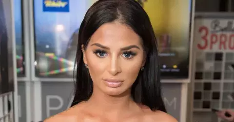 Slovenská celebrita, Zuzana Plačková, prozradila fanouškům pravdu o svých plastikách. ‚‚Milión otázok, nekonečno konšpirácií, čo všetko mi robil!’’