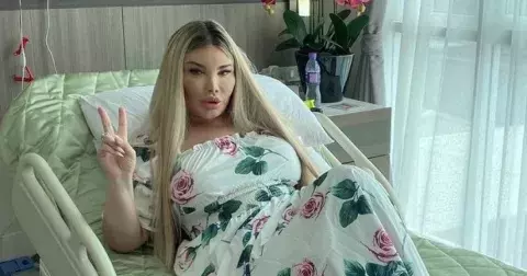 Bývala Ken, nyní je z ní po více než 90 operacích Barbie. Jessica Alves si nechala udělat oči jako Bella Hadid