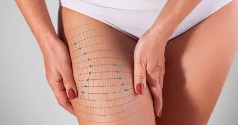 Zpevněte svá stehna díky těmto nejúčinnějším cvikům, které zvládnete i doma: Horolezec, dřep u zdi nebo stání na špičkách