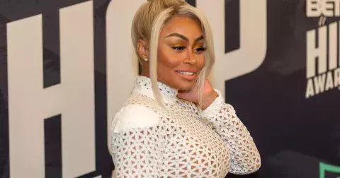 Hollywood se rozpouští: Slavné celebrity litují svých výplní a nechávají si je odstranit