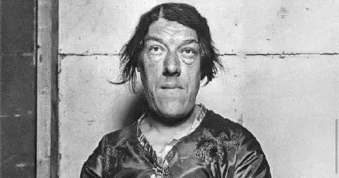 Těžký osud Mary Ann Bevan: Z krásné ženy se stala nejošklivější cirkusovou atrakcí na světě