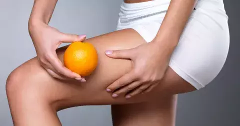 Trápí vás nevzhledná celulitida? Zbavte se jí prostřednictvím těchto triků