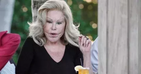 Nechvalně proslulá kočičí žena Jocelyn Wildenstein: Plastikami znetvořená dáma tvrdí, že nikdy žádné úpravy obličeje nepodstoupila