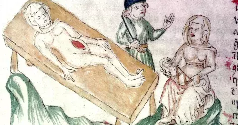 První žena, která přežila porod císařským řezem: Beatrix Bourbonské rozřízli břicho, protože mysleli, že už je stejně mrtvá