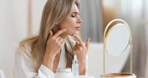 Pupínky po čtyřicítce: Dermatoložka radí, jak se jich zbavit z pohodlí domova