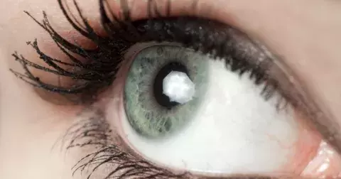 Je vám přes čtyřicet? Hlídejte si oči!