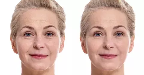 Věci, které urychlují stárnutí: Děláte je taky?