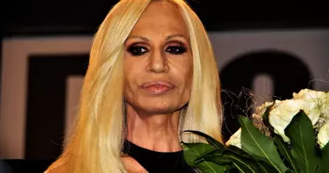 Když plastika škodí: Které celebrity se změnily k nepoznání?