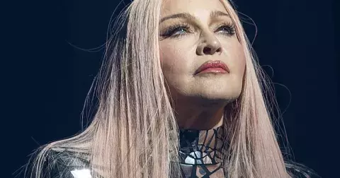 Celebrity, které to přehnaly s plastikami. Nejen ženy se mění k nepoznání