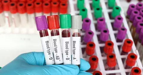 Vědecká studie: Zdraví může ovlivnit i vaše krevní skupina