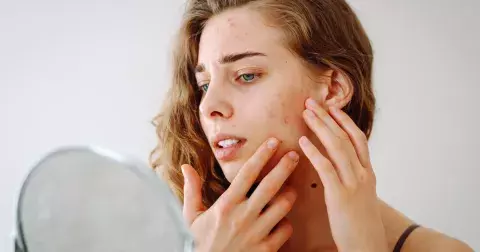 Zbavte se pigmentových skvrn snadno a rychle pomocí babských rad, které opravdu fungují