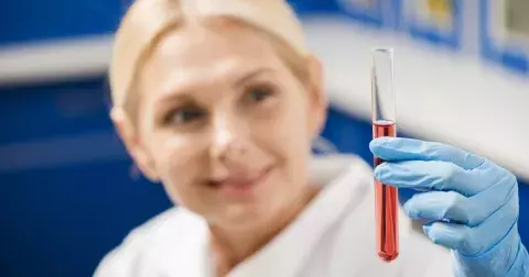 Krevní skupina dokáže odhalit vaši povahu, ale i predispozice k nemocem, říkají odborníci