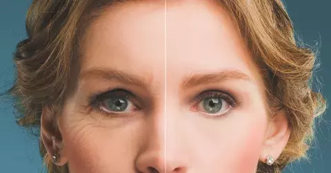 Pokožka poškozená slunečním zářením: Dermatologové radí, jak se zbavit pigmentových skvrn a vrásek