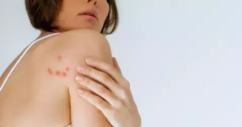 Ne každý suvenýr z cest nám udělá radost. Jak se vyhnout štěnicím a co dělat, když už je doma objevíte?