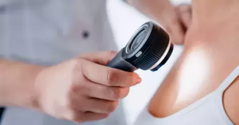 Rakovina kůže: Nemoc pomůže odhalit včas jeden opomíjený příznak. Světlá pleť je nejrizikovější