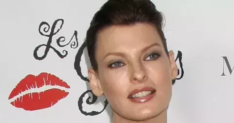 Topmodelka Linda Evangelista: Kdysi by za méně jak 10 000 dolarů nevstala. Dnes je její tělo zohyzděné kosmetickými zákroky