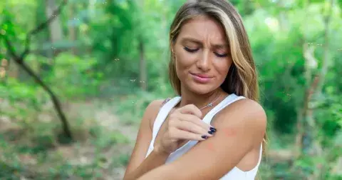 Toto je jediná věc, kterou byste podle odborníků nikdy neměli dělat, když vás píchne komár. Může za ni histamin