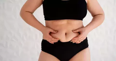 Příliš mnoho sladkostí nebo příliš mnoho stresu? Jak vypadá stresové břicho a jak se ho zbavit